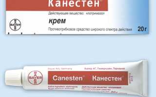 Канестен