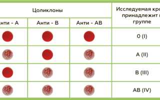 Анализ крови на резус-фактор